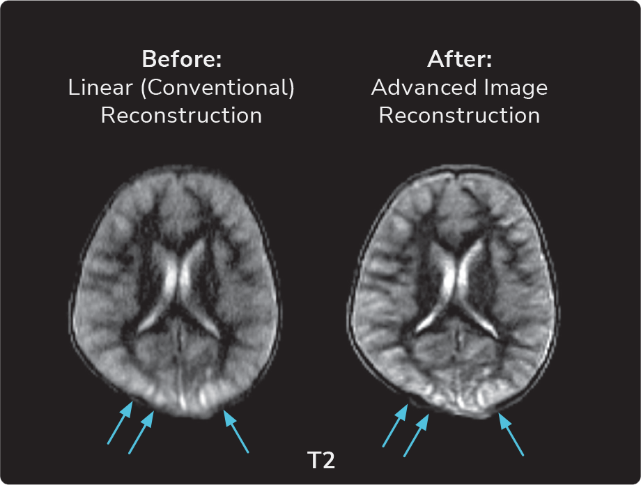 What Is Image Reconstruction