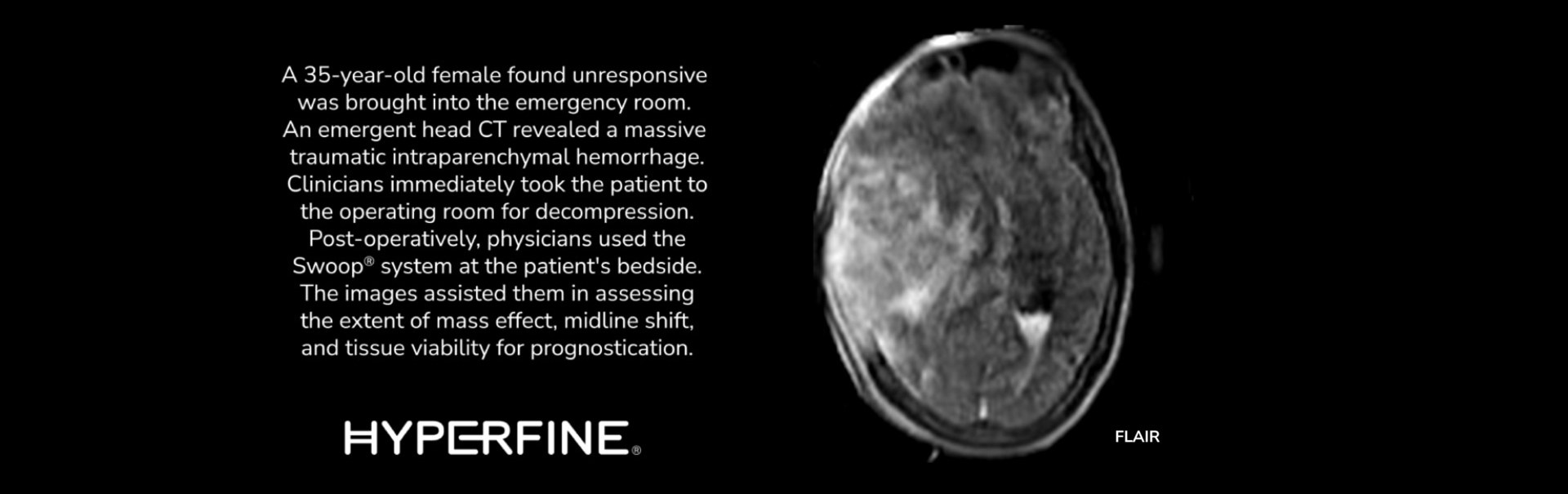 Post-operative Clinical images