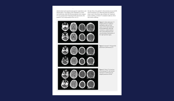 Exploring Portable MR Brain Imaging in a Complex Clinical Scenario with  Severe Head Trauma and Agitation Due to Increased Intracranial Pressure