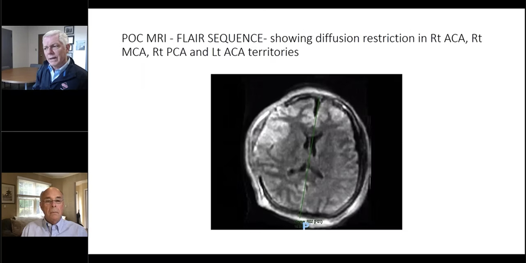 Hyperfine Webinar: Implementing Low-Field, Point-of-Care MR Imaging in ...